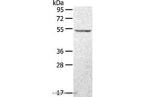 Western blot analysis of A431 cell, using STYK1 Polyclonal Antibody at dilution of 1:500 (STYK1 anticorps)