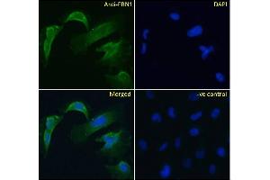 (ABIN570798) Immunofluorescence analysis of paraformaldehyde fixed U251 cells, permeabilized with 0.