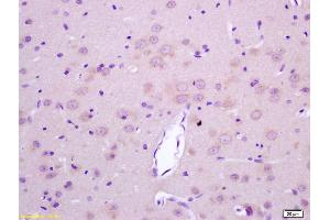 Formalin-fixed and paraffin embedded rat brain labeled with Rabbit Anti LGI1/ETL1 Polyclonal Antibody, Unconjugated (ABIN720430) at 1:200 followed by conjugation to the secondary antibody and DAB staining (LGI1 anticorps  (AA 451-557))