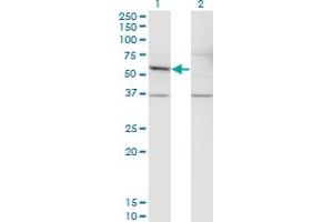 Western Blot analysis of DFNA5 expression in transfected 293T cell line by DFNA5 monoclonal antibody (M01), clone 1E10.