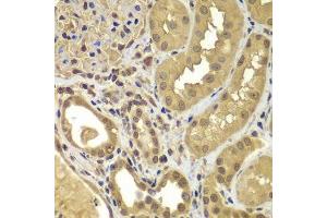 Immunohistochemistry of paraffin-embedded human kidney using SORT1 antibody.