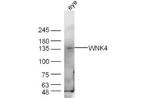Mouse eye lysates probed with WNK4 Polyclonal Antibody, Unconjugated  at 1:300 dilution and 4˚C overnight incubation.