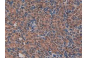 IHC-P analysis of Rat Kidney Tissue, with DAB staining. (MYH6 anticorps  (AA 419-666))