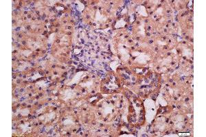 Formalin-fixed and paraffin embedded rat kidney labeled with Rabbit Anti-ATG9A(Ser735) Polyclonal Antibody, Unconjugated (ABIN756307) at 1:200 followed by conjugation to the secondary antibody and DAB staining (ATG9A anticorps  (pSer735))