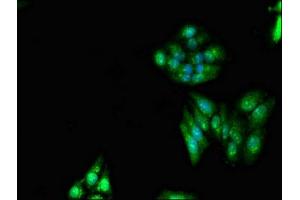 Immunofluorescent analysis of HepG2 cells using ABIN7151204 at dilution of 1:100 and Alexa Fluor 488-congugated AffiniPure Goat Anti-Rabbit IgG(H+L) (RNF6 anticorps  (AA 1-298))