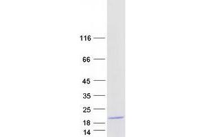 Validation with Western Blot
