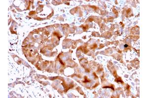 Formalin-fixed, paraffin-embedded human Liver tissue stained with FABP5 Mouse Monoclonal Antibody (FABP5/3750). (FABP5 anticorps)
