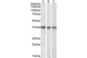 ABIN571286 (1µg/ml) staining of K562 (A), MCF7 (B) and Mouse Liver (C) lysates (35µg protein in RIPA buffer). (POLDIP2 anticorps  (Internal Region))