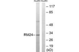 Western blot analysis of extracts from HuvEc cells, using MRPL24 Antibody. (MRPL24 anticorps  (AA 101-150))