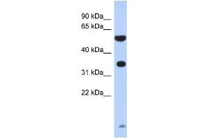 Western Blotting (WB) image for anti-Protease, serine, 48 (PRSS48) antibody (ABIN2460080) (ESSPL anticorps)