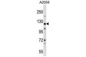 BAT3 Antibody (C-term) western blot analysis in A2058 cell line lysates (35µg/lane). (BAT3 anticorps  (C-Term))