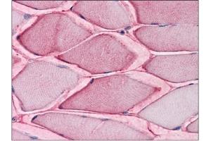 Human Skeletal Muscle: Formalin-Fixed, Paraffin-Embedded (FFPE) (SLC1A5 anticorps  (Internal Region))