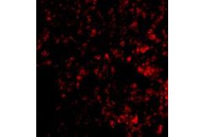 Immunofluorescence of PRDM1 in mouse lung tissue with PRDM1 polyclonal antibody  at 20 ug/mL . (PRDM1 anticorps  (C-Term))