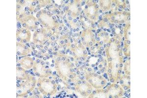 Immunohistochemistry of paraffin-embedded Rat kidney using NAA50 Polyclonal Antibody at dilution of 1:200 (40x lens). (NAA50 anticorps)