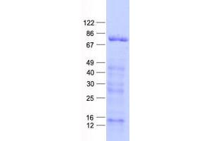 Validation with Western Blot