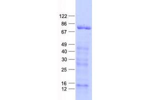 Validation with Western Blot (ARHGAP22 Protein (His tag))