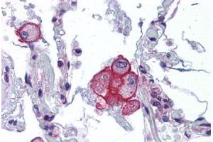Human Lung: Formalin-Fixed, Paraffin-Embedded (FFPE)