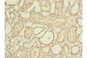 Immunohistochemistry of paraffin-embedded human kidney tissue using ABIN7168993 at dilution of 1:100 (STK33 anticorps  (AA 231-514))