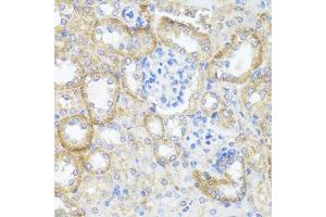 Immunohistochemistry of paraffin-embedded mouse kidney using ASL antibody (ABIN6127448, ABIN6137201, ABIN6137202 and ABIN6221972) at dilution of 1:100 (40x lens).