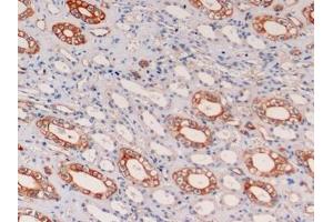 Detection of CK19 in Human Kidney Tissue using Monoclonal Antibody to Cytokeratin 19 (CK19) (Cytokeratin 19 anticorps  (AA 245-391))