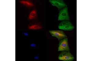 ABIN6262986 and ABIN6278409 staining  cells by IF/ICC. (LMAN1 anticorps  (Internal Region))