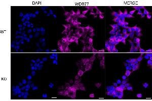 anti-WD Repeat Domain 77 (WDR77) antibody