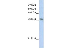 Western Blotting (WB) image for anti-Phytanoyl-CoA 2-Hydroxylase Interacting Protein (PHYHIP) antibody (ABIN2460831) (PHYHIP anticorps)
