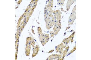 Immunohistochemistry of paraffin-embedded human esophageal smooth muscle using MRPL12 antibody (ABIN5974554) at dilution of 1/100 (40x lens). (MRPL12 anticorps)