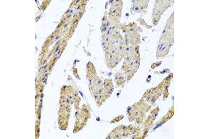 Immunohistochemistry of paraffin-embedded human esophageal smooth muscle using MRPL12 antibody (ABIN5974554) at dilution of 1/100 (40x lens). (MRPL12 anticorps)