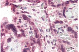 Human Placenta (formalin-fixed, paraffin-embedded) stained with CCKBR antibody ABIN337053 at 5 ug/ml followed by biotinylated anti-goat IgG secondary antibody ABIN481715, alkaline phosphatase-streptavidin and chromogen. (CCKBR anticorps  (AA 251-266))