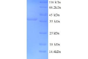 SDS-PAGE (SDS) image for Glutamate Receptor, Ionotropic, Kainate 5 (GRIK5) (AA 143-238), (Extracellular) protein (GST tag) (ABIN5713836)