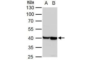 WB Image alpha Actin (cardiac muscle) antibody detects alpha Actin (cardiac muscle) protein by western blot analysis. (ACTC1 anticorps)