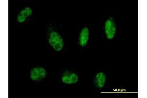 Immunofluorescence of purified MaxPab antibody to MTMR8 on HepG2 cell. (MTMR8 anticorps  (AA 1-704))