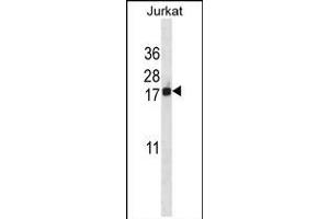 BANF1 Antibody (Center) (ABIN657992 and ABIN2846938) western blot analysis in Jurkat cell line lysates (35 μg/lane). (BANF1 anticorps  (AA 37-65))