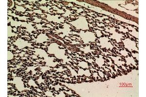 Immunohistochemistry (IHC) analysis of paraffin-embedded Mouse Lung, antibody was diluted at 1:100.