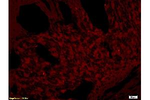 Formalin-fixed and paraffin embedded rat skin tissue labeled with Rabbit Anti-CD272/BTLA Polyclonal Antibody (ABIN671031), Unconjugated at 1:200 followed by conjugation to the secondary antibody and DAB staining.