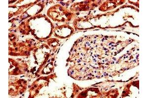 Immunohistochemistry of paraffin-embedded human kidney tissue using ABIN7143637 at dilution of 1:100