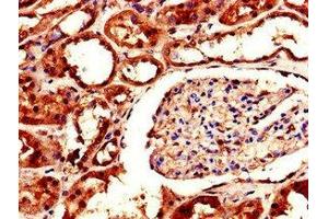 Immunohistochemistry of paraffin-embedded human kidney tissue using ABIN7143637 at dilution of 1:100 (AKR1A1 anticorps  (AA 2-325))