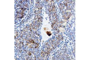 IHC analysis of EEF2 using anti-EEF2 antibody (ABIN7599561). (EEF2 anticorps  (AA 1-858))