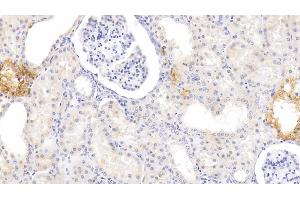 Detection of MTNR1A in Human Kidney Tissue using Polyclonal Antibody to Melatonin Receptor 1A (MTNR1A) (Melatonin Receptor 1A anticorps  (AA 296-350))