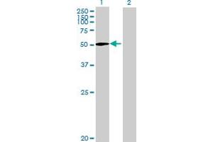 Western Blot analysis of ZNF549 expression in transfected 293T cell line by ZNF549 MaxPab polyclonal antibody.