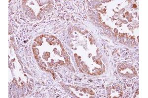 Image no. 1 for anti-Aspartyl-tRNA Synthetase (DARS) (AA 304-501) antibody (ABIN1497768)