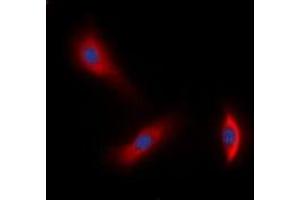Immunofluorescent analysis of HER3 staining in A549 cells. (ERBB3 anticorps  (C-Term))