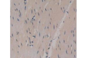 Used in DAB staining on fromalin fixed paraffin- embedded Kidney tissue (UCK2 anticorps  (AA 18-261))