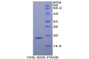 SDS-PAGE analysis of Human Neurotensin Protein. (Neurotensin Protein (NTS))