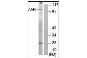 Western blot analysis of extracts from 293 cells, using AhR Antibody. (Aryl Hydrocarbon Receptor anticorps  (N-Term))