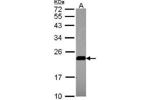 WB Image Sample (30 ug of whole cell lysate) A: A549 12% SDS PAGE antibody diluted at 1:1000 (Caveolin 2 anticorps  (N-Term))