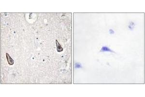 Immunohistochemistry analysis of paraffin-embedded human brain tissue, using ADCY5/6 Antibody. (ADCY5/6 anticorps  (AA 931-980))