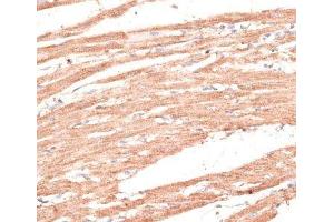Immunohistochemistry of paraffin-embedded Rat heart using KIF1C Polyclonal Antibody at dilution of 1:100 (40x lens). (KIF1C anticorps)