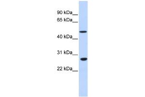 WB Suggested Anti-ZNF556 Antibody Titration:  0. (ZNF556 anticorps  (N-Term))